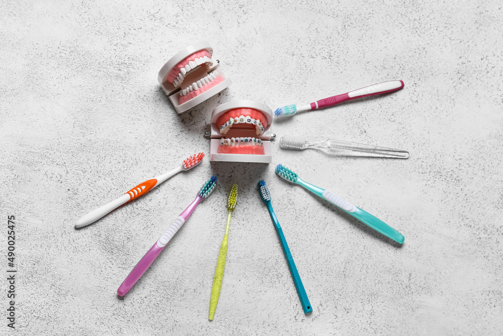 Model of jaws with braces and toothbrushes on light background Model of jaws with braces and toothbrushes on light background