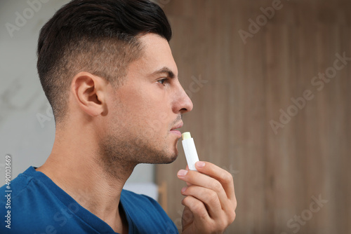 Handsome man applying hygienic lip balm indoors