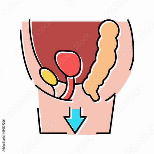 organ prolapse disease color icon vector illustration