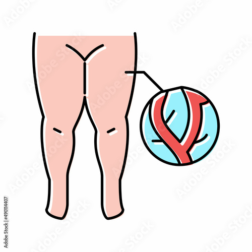 lymphatic edema color icon vector illustration