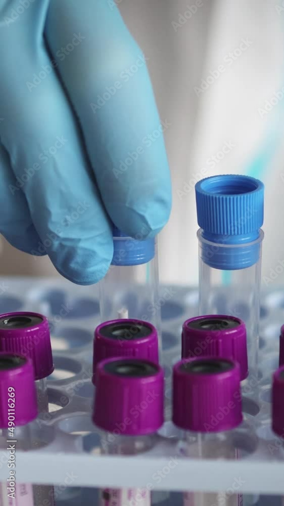 Vidéo Stock Process of coronavirus PCR antigen testing examination by