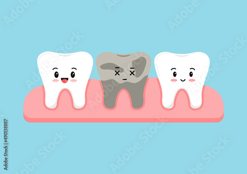 Cute teeth in gum with dead decay sad tooth kids dentistry sign isolated on blue background. Tooth row in jaw flat design kawaii cartoon style vector baby dental health illustration.