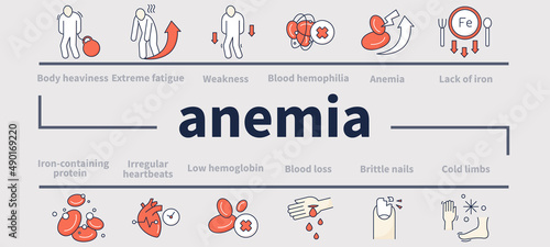 Anemia disease infographics. Disease symptoms layout, info chart, banner. Testing, prevention of sicks. Health protection vector presentation.