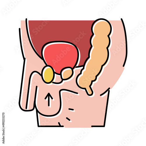 cryptorchidism disease color icon vector illustration