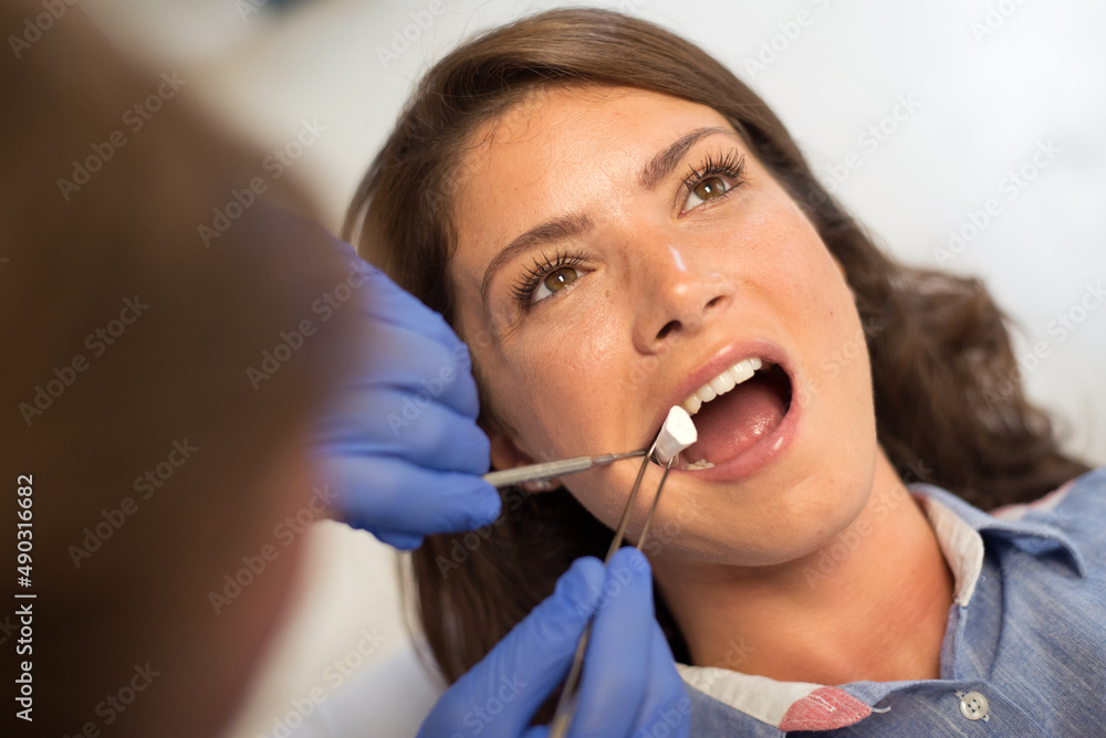 Young woman checking her teeth at the dentist clinic.