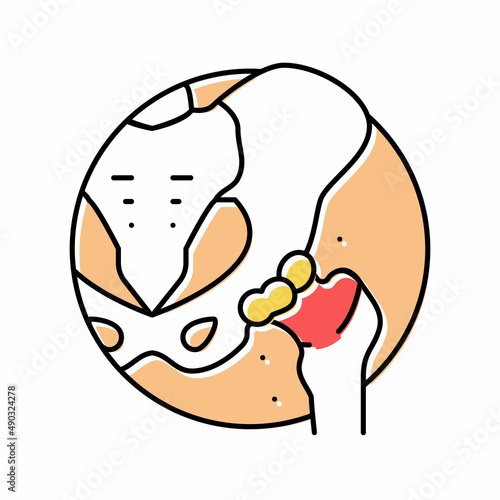 articular cartilage gout color icon vector illustration