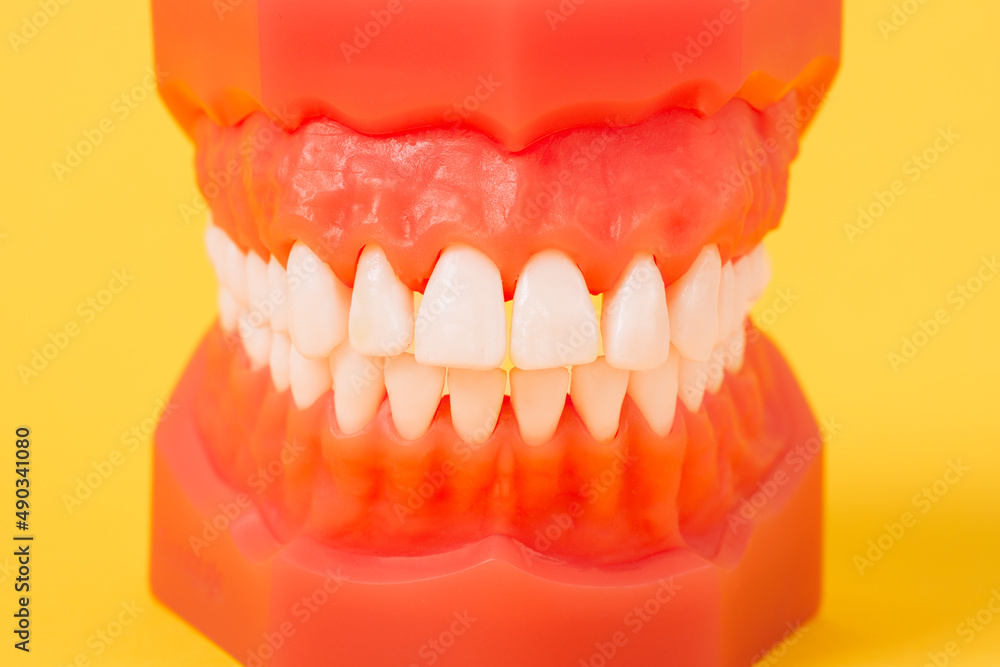 Obraz premium Closeup model with white teeth on yellow background. Jaw in dentistry. Clean denture, model of the jaw. Dental, oral surgery, stomatology, orthodontist concept