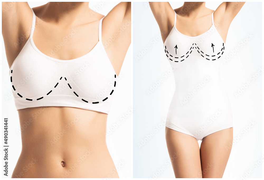 Perfect body of young and beautiful woman in swimsuit. Collage with arrows. Weight loss, sport and aesthetic medicine. Perfect body of young and beautiful woman in swimsuit. Collage with arrows. Weight loss, sport and aesthetic medicine.