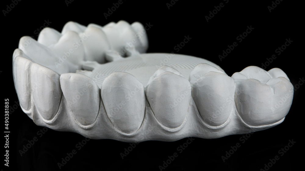 morphology and relief of a milled zircon dental prosthesis on a black background morphology and relief of a milled zircon dental prosthesis on a black background