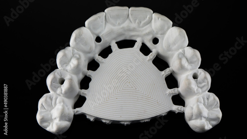 top view of the morphology and structure of the teeth of a zircon dental prosthesis on a black background