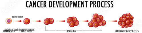 Cancer development process infographic