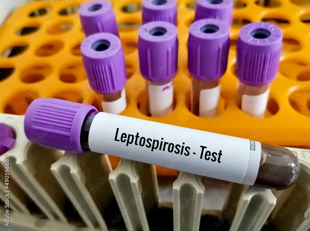 Blood sample tube for Leptospirosis test at laboratory Stock Photo