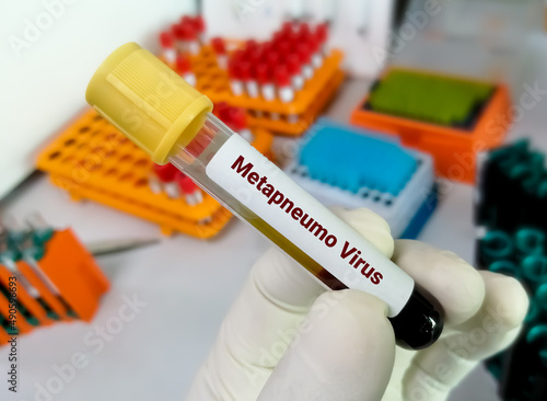 Blood sample tube for Metapneumo virus test, metapneumo virus can cause respiratory disease.