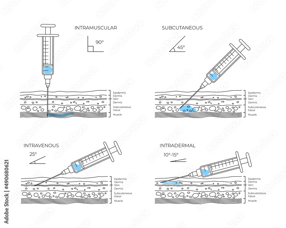 types-of-injections-guide-to-injecting-vaccines-into-skin-medical