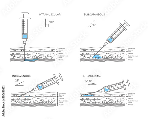 Types of injections. Guide to injecting vaccines into skin. Medical procedure manuals for hospital workers. Set vector illustration