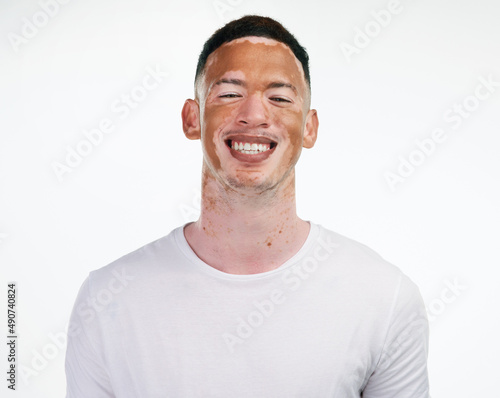 I have my flaws but I embrace them and love them because theyre mine. Portrait shot of a handsome young man with vitiligo posing on a white background. photo