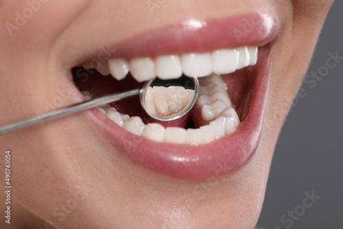 Examining woman s teeth with dentist s mirror on grey background  closeup