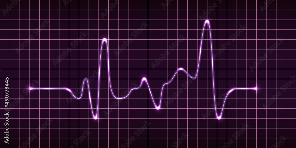 Electric impulse signal, heart beat pulse monitor, oscilloscope electrocardiogram graph. Purple glowing electric light effect. MOdern technology vector illustration Electric impulse signal, heart beat pulse monitor, oscilloscope electrocardiogram graph. Purple glowing electric light effect. MOdern technology vector illustration