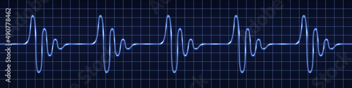 Heart beat pulse. Sine wave impulse signal. Oscilloscope monitor display, Blue light glow. Electrocardiogram graph line. Technology vector illustration