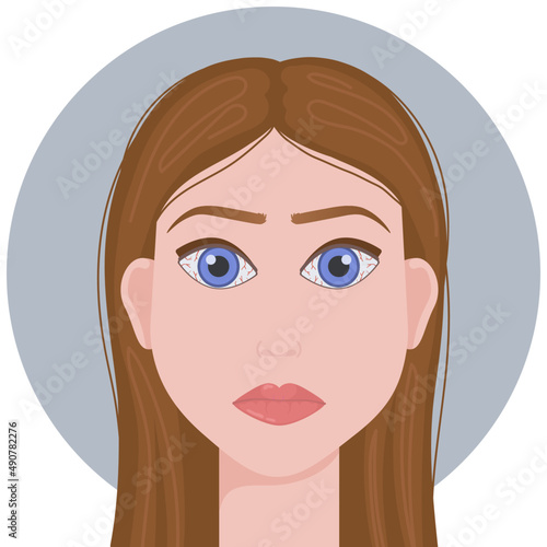 conjunctivitis illustration
