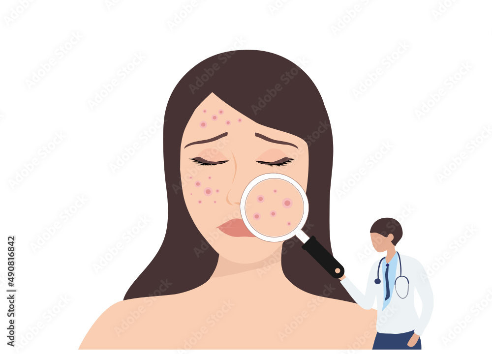 Dermatologist checking young woman face with skin acne, pimples, blackheads vector illustration. Acne skin face problem concept Dermatologist checking young woman face with skin acne, pimples, blackheads vector illustration. Acne skin face problem concept