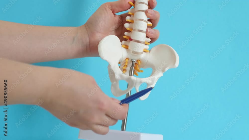 Intervertebral hernia of the cervical spine, rupture of the fibrous ...