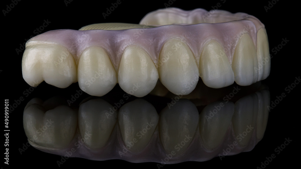 excellent angle on the prosthesis of the upper jaw with painted pink gums on black glass excellent angle on the prosthesis of the upper jaw with painted pink gums on black glass