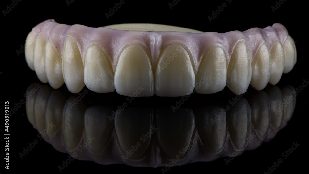 excellent angle with the prosthesis of the upper jaw with a painted pink artificial gum on black glass with reflection excellent angle with the prosthesis of the upper jaw with a painted pink artificial gum on black glass with reflection