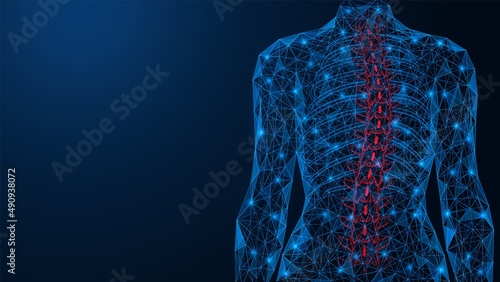 Scoliosis, curvature of the spine. Incorrect deformation of the human back. Polygonal design of interconnected lines and points. Blue background. photo