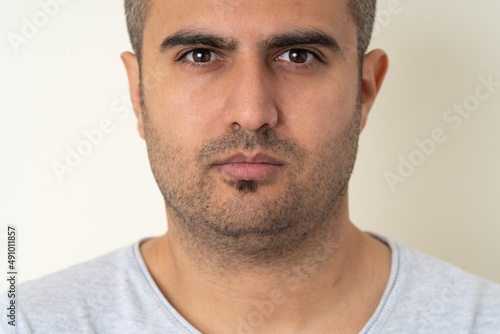 Close up photo of  a man with uneven ear problem. Concept of otoplasty  and ear surgery. Selective focus. photo