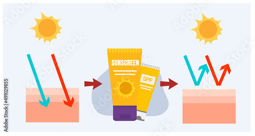 vector infographic of Sun protection,skin care concept,sunscreen, sunblock.before after using sunscreen product on skin layers.