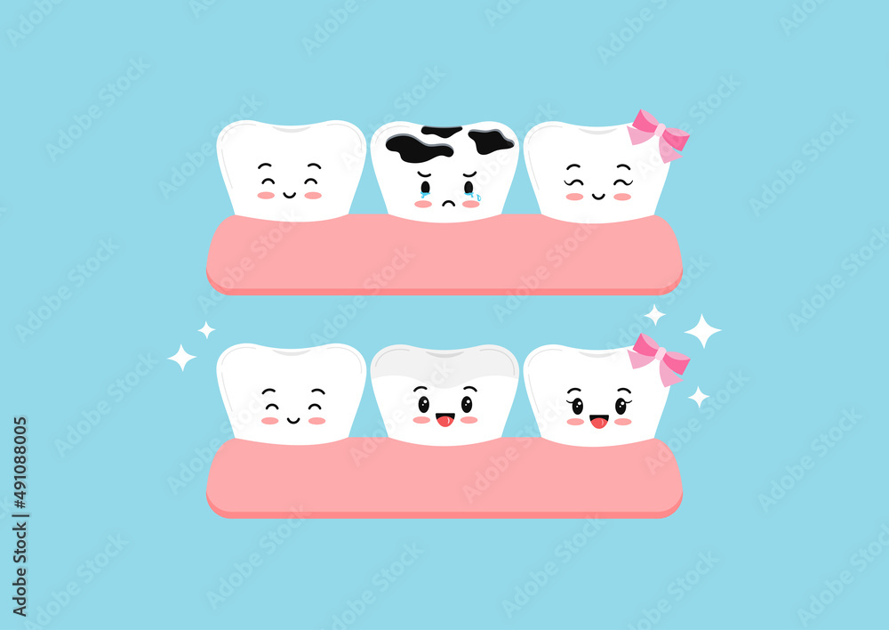 Cute teeth before and after multiple caries in gym dental characters. Tooth dentistry restoration with ceramic porcelain sealant in cavity treatment concept. Flat cartoon clip art vector illustration. Cute teeth before and after multiple caries in gym dental characters. Tooth dentistry restoration with ceramic porcelain sealant in cavity treatment concept. Flat cartoon clip art vector illustration.