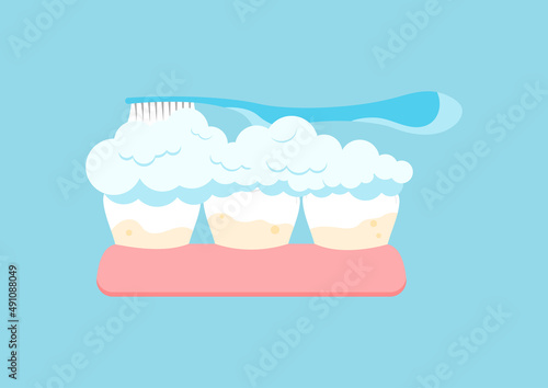 Tooth with yellow tartar plaque cleaning with toothpTooth with yellow tartar plaque cleaning with toothpaste and toothbrush. Teeth in gum stain treatment, remove calculus and cleanaste and toothbrush.