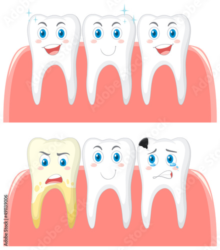 Set of strong teeth and tooth decay on white background