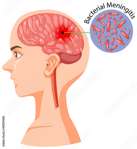 Human head section with brain
