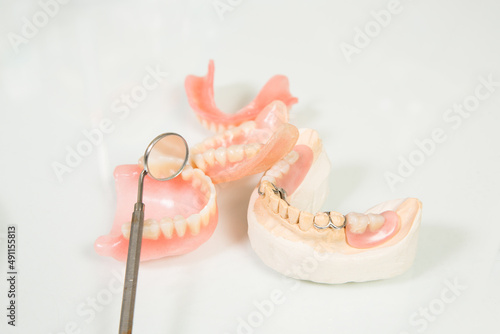 dentures, casts of celusti and stomatological mirror
