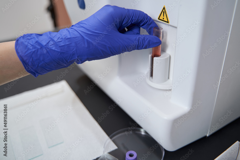 Medical worker taking liquid for research in the hospital Medical worker taking liquid for research in the hospital