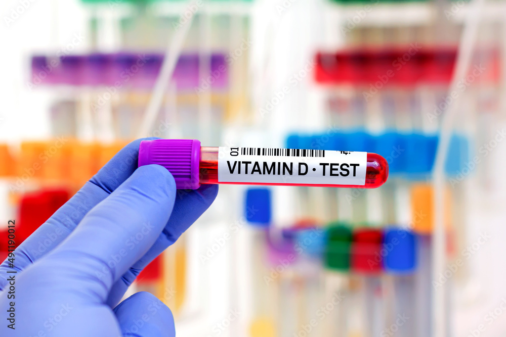 doctor with Blood tube for Vitamin D test. Blood sample of patient for ...
