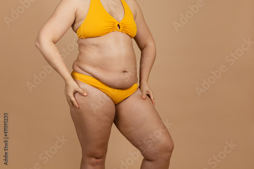 Cropped image of overweight fat naked woman with obesity hips, excess fat in yellow swimsuit. Big size. Holding hips flabs, visceral, cellulite. Self acceptance, body positive, imperfection skin body