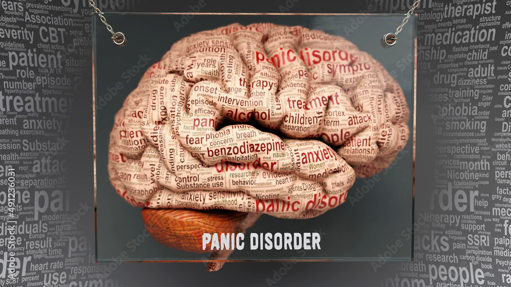 Panic Disorder Anatomy Its Causes And Effects Projected On A Human Panic Disorder Anatomy Its Causes And Effects Projected On A Human