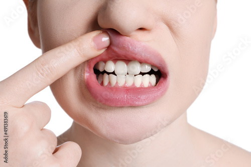 Young woman showing healthy gums on white background, closeup photo