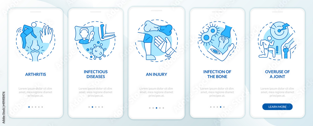 Fototapeta premium Inflammatory joint diseases blue onboarding mobile app screen. Walkthrough 5 steps graphic instructions pages with linear concepts. UI, UX, GUI template. Myriad Pro-Bold, Regular fonts used