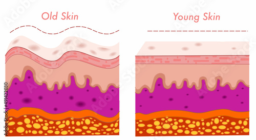 Old skin young skin, differences between. Elastic aging wrinkled, stretched anatomical structure. Skin parts,  dermis wrinkles, epidermis, collagen, elastin section. Grandmother, daughter. Draw vector