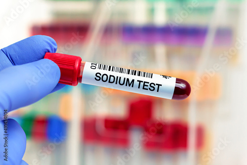 Photos doctor with Blood tube for Sodium test in lab