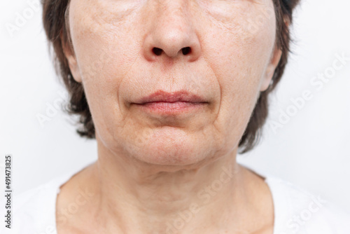 The lower part of elderly woman's face and neck with signs of skin aging isolated on a white background. Age-related changes, flabby sagging facial skin, wrinkles and creases. Cosmetology and beauty