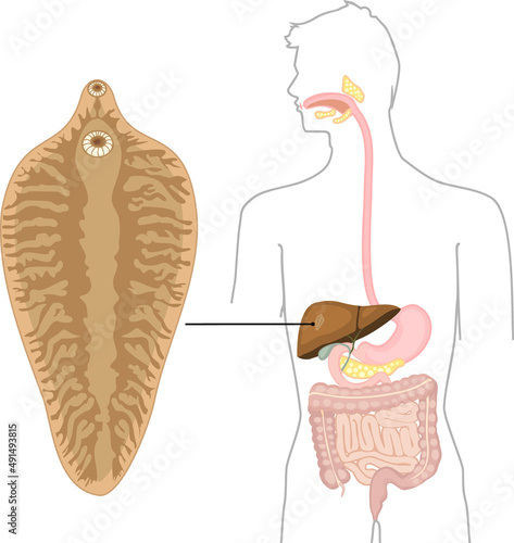 Sheep liver fluke (Fasciola hepatica) and structure of human digestive system. Location of helminth in human body