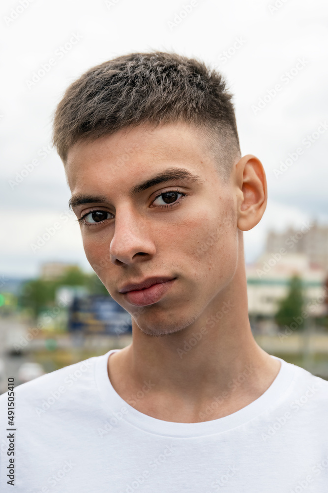 portrait of caucasian handsome teenager with pimples on his face on the outdoor, acne treatment in adolescents portrait of caucasian handsome teenager with pimples on his face on the outdoor, acne treatment in adolescents