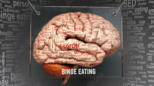 Schilderij op canvas Binge eating anatomy - its causes and effects projected on a human brain revealing Binge eating complexity and relation to human mind