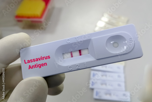 Scientist hand hold rapid test cassette for Lassa virus antigen test, medical and health concept photo