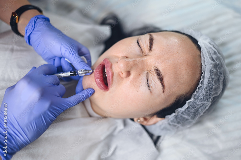 Cosmetologist doing painful lip augmentation procedure with hyaluronic